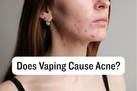 Does Vaping Cause Acne?